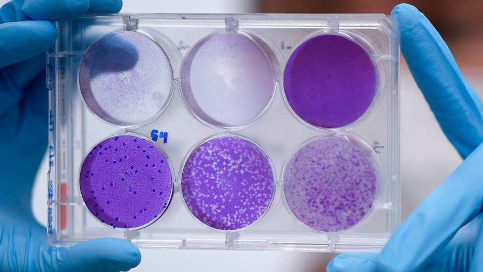 Investigador trabaja en una rÃ©plica del virus para desarrollar una vacuna.