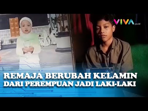 Aneh Tapi Nyata, Lahir Sebagai Perempuan Remaja Ini Berubah Kelamin