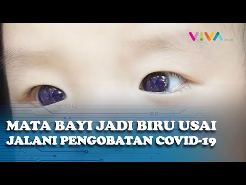 Mata Bayi Berubah Jadi Biru Usai Jalani Pengobatan COVID-19, Kok Bisa?