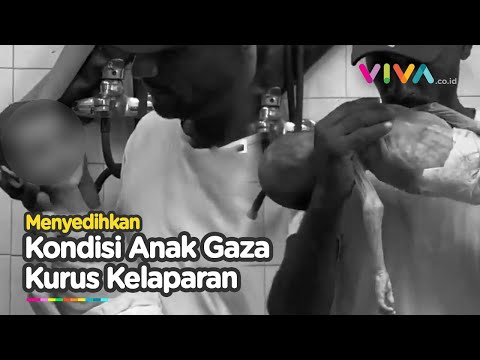 Pemandangan Menyayat Hati, Saat Anak anak di Palestina Mengalami Kekurangan Gizi
