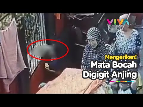 Seorang Bocah Digigit Seekor Anjing Hingga Saraf Mata Putus