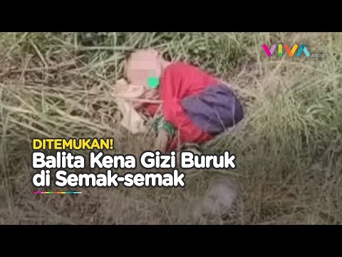 Fakta Mengejutkan Balita dengan Kondisi Gizi Buruk di Semak-semak