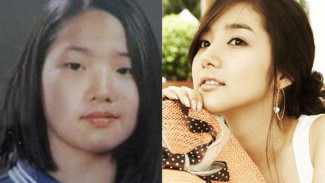 5 Artis Korea yang Operasi Plastik, Ini Potret Transformasinya
