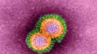China Umumkan Orang Pertama Terinfeksi Virus Flu Burung H10N3