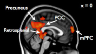 Ini Hasil MRI Otak Remaja yang Memberontak