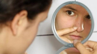 Cara Alami Hilangkan Jerawat Batu di Hidung