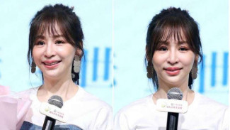 Sempat Heboh Wajah Bengkak, Cyndi Wang Buka Suara