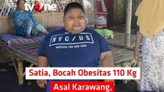 Satia Bocah Obesitas 110 Kg Meninggal Dunia