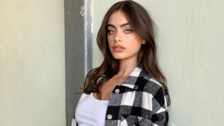 Dinobatkan Wanita Tercantik Dunia, Yael Shelbia Malah Diejek Jelek
