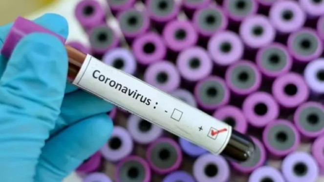 Virus Corona.