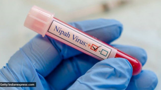 Bisa Jadi Sangat Berbahaya, Dokter Sebut Virus Nipah Bisa Tetap 'Tidur' Hingga 45 Hari