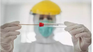 Ini Alasan Omicron Lebih Menular Dibanding Varian COVID-19 Lainnya