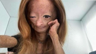 Profil dan Potret Adalia Rose, YouTuber yang Dikabarkan Meninggal