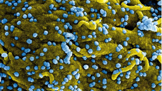 Wabah Virus Marburg Picu Kematian, WHO Wanti-wanti Penularan Lewat Sperma