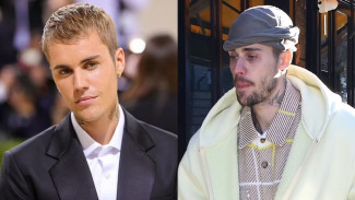 Wajah Justin Bieber Makin Kurus dan Lelah, Trauma Berat Gegara Kasus P Diddy?