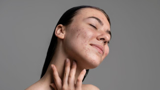 Kecantikan Natural Comeback! Skinimalisme Kembali Populer di 2025