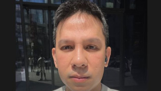 Jordi Onsu Blak-blakan Jalani Operasi Hidung di Korea Karena Ingin Lebih Ganteng