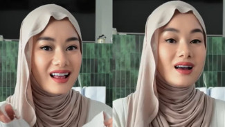 Wajah Terkini Dinda Hauw Bikin Pangling, Alis dan Gigi Jadi Sorotan